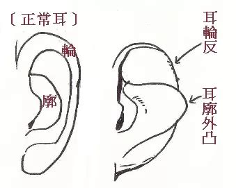 大耳 面相|面相耳朵案例详解：九种不同的耳朵，九种不同的出生